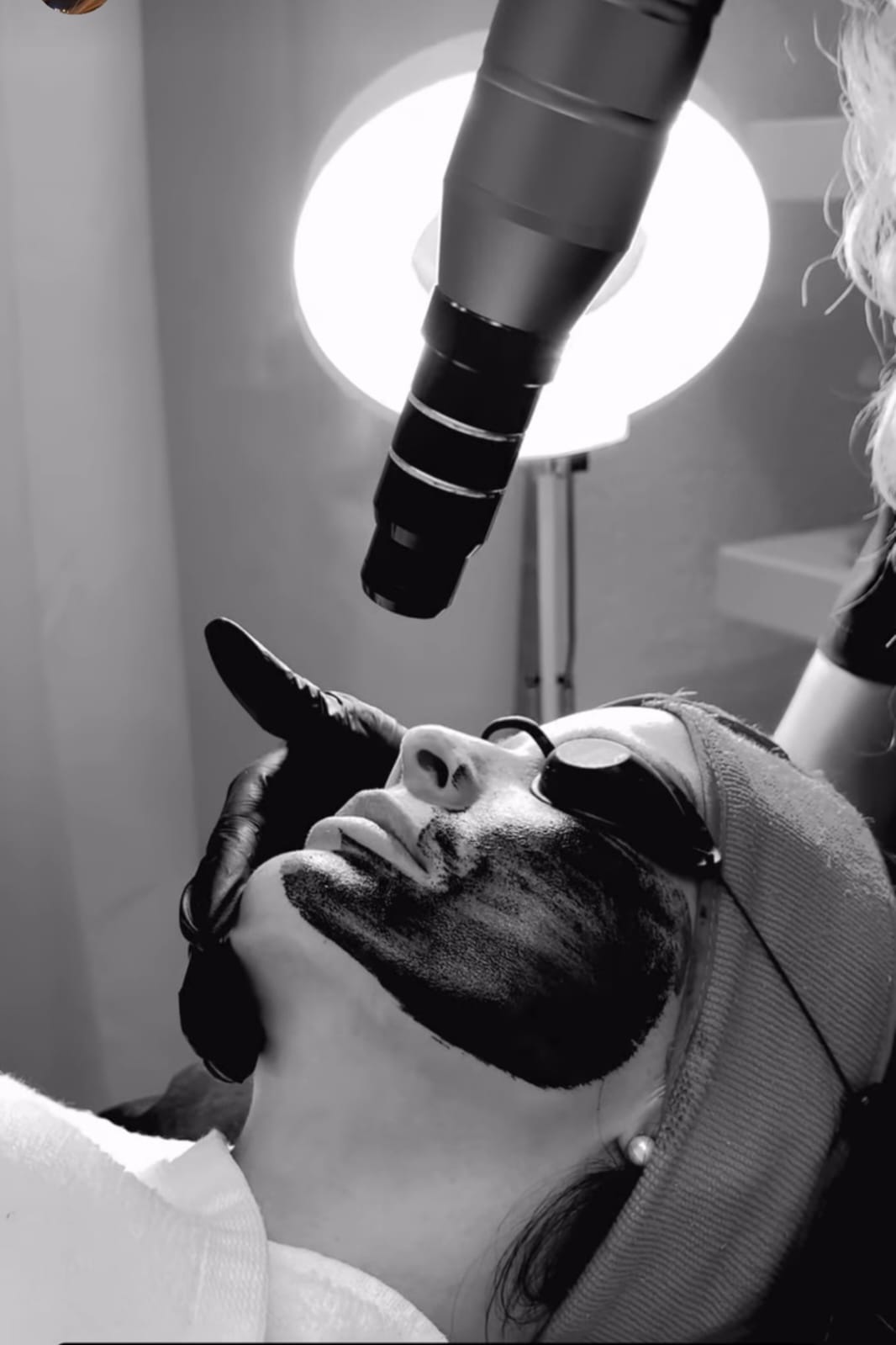 Hollywood Peel